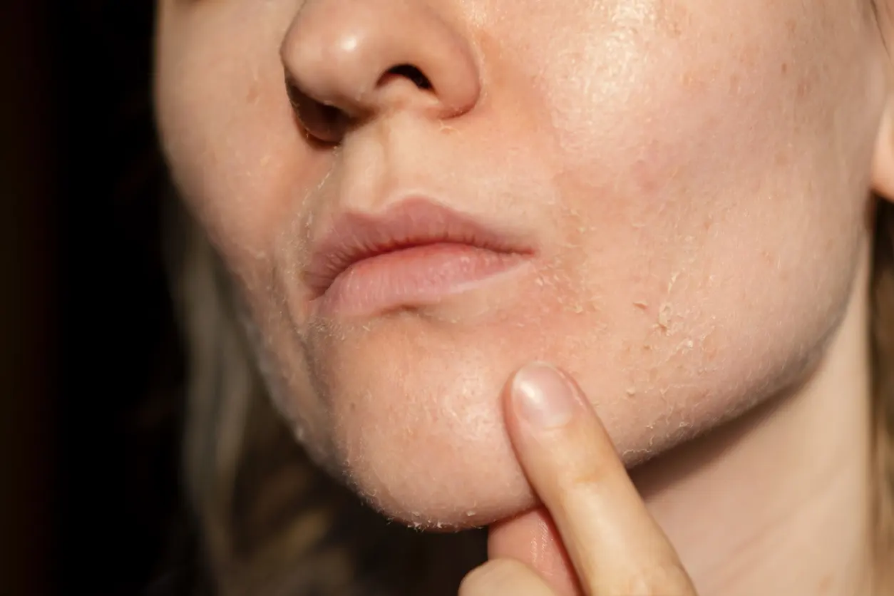 How Does Drug Abuse Affect Skin Health?